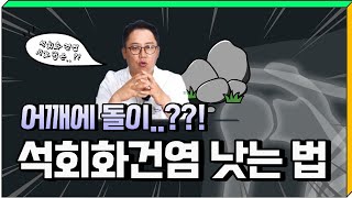 갑자기 생긴 어깨 통증? 어깨 석회화건염 낫는 법!