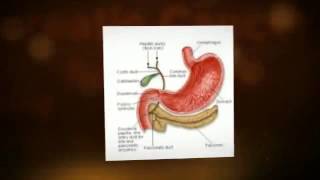 Cause Of Pancreatic Cancer