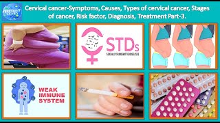 Cervical Cancer Symptoms, Causes, Types, Stages of cancer, Risk factor, Diagnosis, Treatment Part-3