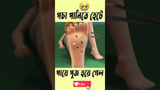 Foot pooja treatment #shorts #youtubeshorts #trending #viral #doctor #tuin