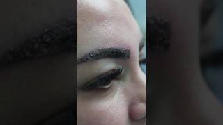 MY EYEBROW TRANSPLANT Experience | HerDubai Marina