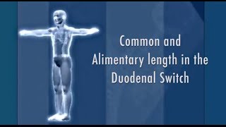 Length Measurment in Duodenal Switch