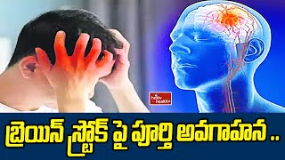 Brain Stroke :  బ్రెయిన్ స్ట్రోక్ పై పూర్తి అవగాహన ..| hmtv healthplus