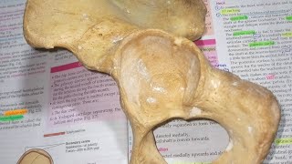 Acetabulum and Obturator foramen| Human Anatomy