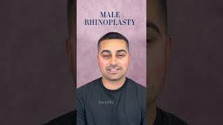 AMAZING rhinoplasty transformation on this male patient!