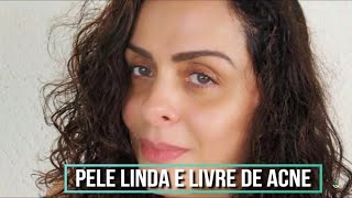 DICAS PARA UMA PELE LINDA, SAUDÁVEL E LIVRE DE ACNE - DICAS DE BELEZA! Por Vanessa Machadoa