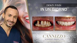 Denti Fissi in Un Giorno - Cannizzo Studio