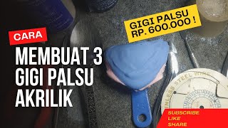 Cara Membuat Gigi Palsu Akrilik Secara Intan Cepat Dan Mudah