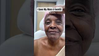 Plastic Surgeon Gives His Mom a Facelift! THE BIG REVEAL 🤯