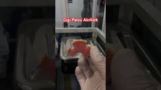 Gigi Palsu Yang Bagus Dan Nyaman