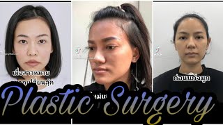 Plastic Surgery Transformation