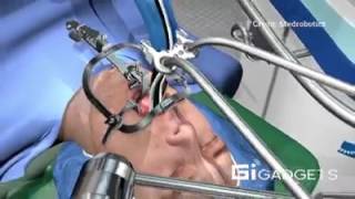 surgical robot snakes