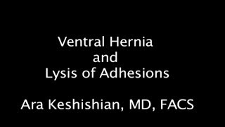 Abdominal Wall hernia, internal hernia