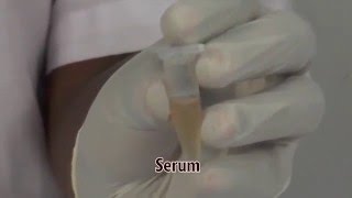 YBIO - HCV SERUM/PLASMA LATERAL FLOW TEST