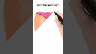 Rectal Cancer Meaning in Marathi #shorts