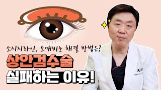 처진눈 해결하려다 소시지쌍꺼풀(소세지눈) 된다고요?! 상안검수술, 실패없는 눈꺼풀처짐 개선 방법은? - 의학박사 백승준