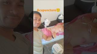 Acupuncture,Ventusa & Body Massage #acupuncture#massage#shorts#mjarcillasvlog#nextvlog