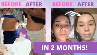 CLIENT GUT HEALING TRANSFORMATION | No Gallbladder & Low Stomach Acid