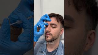 Treating Facial Wrinkles with Daxxify!