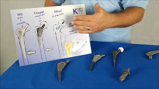 Different Hip Stem Options | K-implant Info Channel