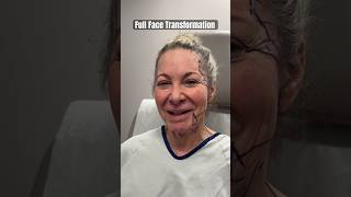 LIFE CHANGING FACIAL TRANSFORMATION #plasticsurgery #transformationjourney