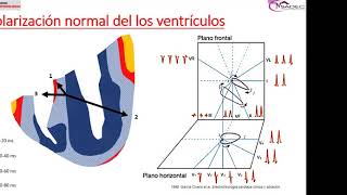 9 - Bloqueos fasciculares y Hemibloqueos