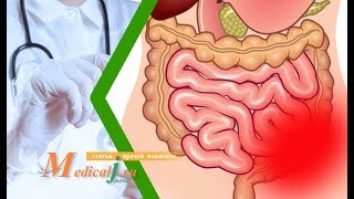 Острая кишечная непроходимость: причины, симптомы и лечение