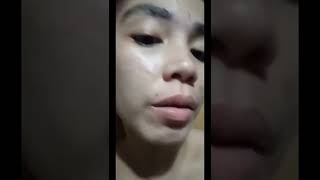 ROSMAR KAGAYAKU REJUVENATING SET REVIEW ((DAY3)) nagbabalat na sya Kaya mejo mahapdi na ❤️💕🔥