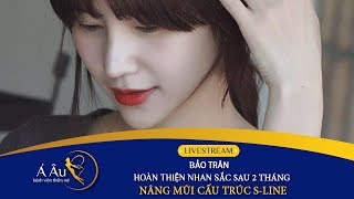 Hotgirl Bảo Trân chia sẻ cảm nhận sau 2 tháng nâng mũi