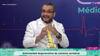 Enfermedad degenerativa de columna vertebral