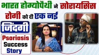 भारत होम्योपैथी ने सोरायसिस रोगी को दी एक नई जिंदगी | Psoriasis Success Story