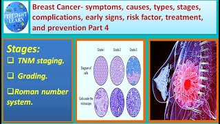 Breast Cancer  symptoms, causes, types, complications, stages,risk factor,treatment Part 4