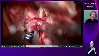 NEUROLOGIA MESA 1 Neurocirurgia Funcional