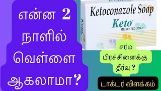 keto soap review/ skin whitening soap/antifungal soap/best soap( tamil)