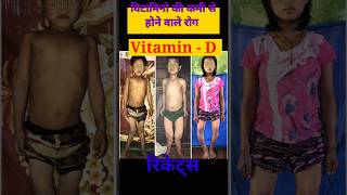 विटामिनो की कमी से होने बाले रोग ll Vitamin #shorts #youtubeshorts