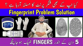 fingerprint problem | recover fingerprint | solution fingerprint | fingerprint issue | fingerprint