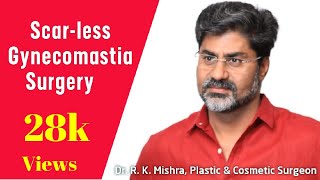 Gynecomastia Surgery in Lucknow | Scar-less Trans-Nipple Incision by Dr. R. K. Mishra