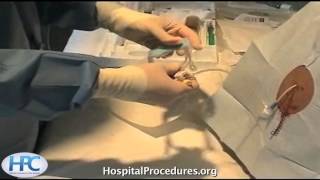 Ultrasound Guided Thoracentesis Video Trailer