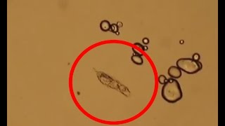 Watch a tiny animal (rotifer) in a drop of water under the microscope - biology class