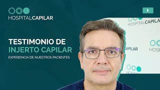 💥 TESTIMONIO TRAS UN INJERTO CAPILAR ⎮ La experiencia del injerto en boca de nuestros pacientes 💯