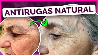 Tratamento Natural para rugas com Óleos Essenciais