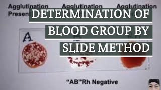 DETERMINATION OF BLOOD GROUP BY SLIDE METHOD/ MTC