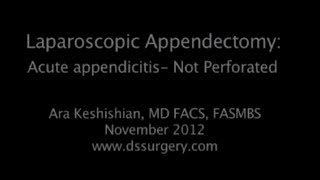 Laparoscopic Appendectomy #1