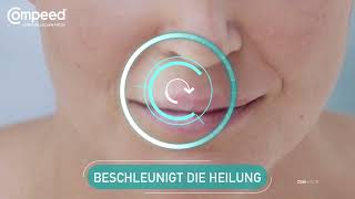 Compeed® Herpesbläschen Patch - Beschleunigt Heilung & reduziert das Ansteckungsrisiko – comp