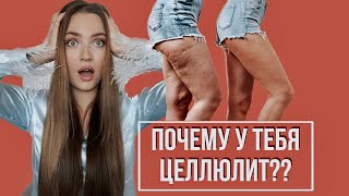 ТОП-5 ГОРМОНОВ, из-за которых у тебя целлюлит | или «Почему у меня целлюлит?»