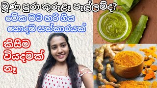 කුරුළෑ කැළැල් නැති කරගන්නෙ කොහොමද? How to remove pimple marks at home #homeremedy #acne #beautytips