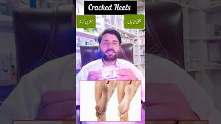 cracked Heels | phati ariyan | cream | best cream #viral #shortviral #viralvideo