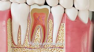 Dental animation Demo