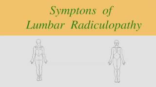 Radiculopothy Clinical Pattern