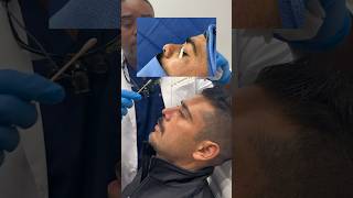 Bull Riding Accident Leads to Life Changing Rhinoplasty